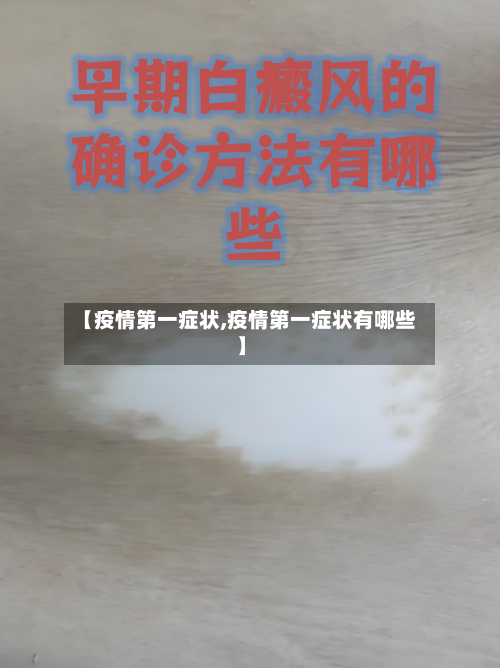 【疫情第一症状,疫情第一症状有哪些】